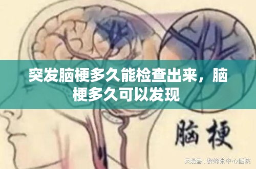 突发脑梗多久能检查出来，脑梗多久可以发现 